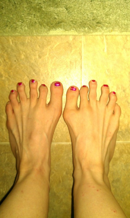 6本指の足