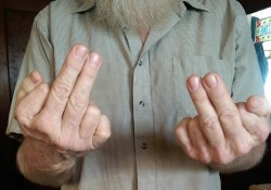 私の父は６本指の手を持っている。